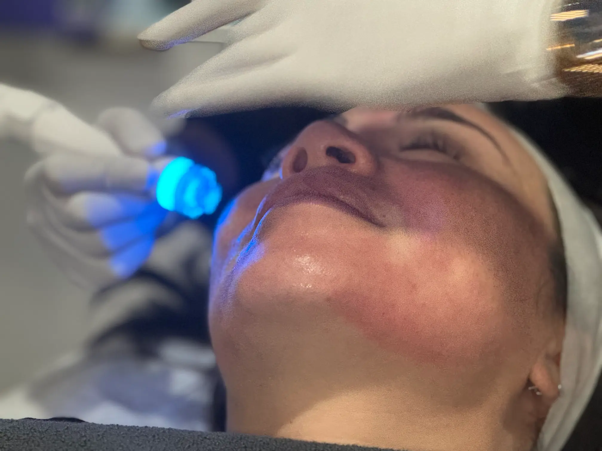 Close-up of a client receiving an AQUA PURE FACIAL, a skin-rejuvenating treatment that exfoliates, lifts, and infuses the skin with glow-boosting serums, administered by a gloved practitioner at La Maison Beauté.