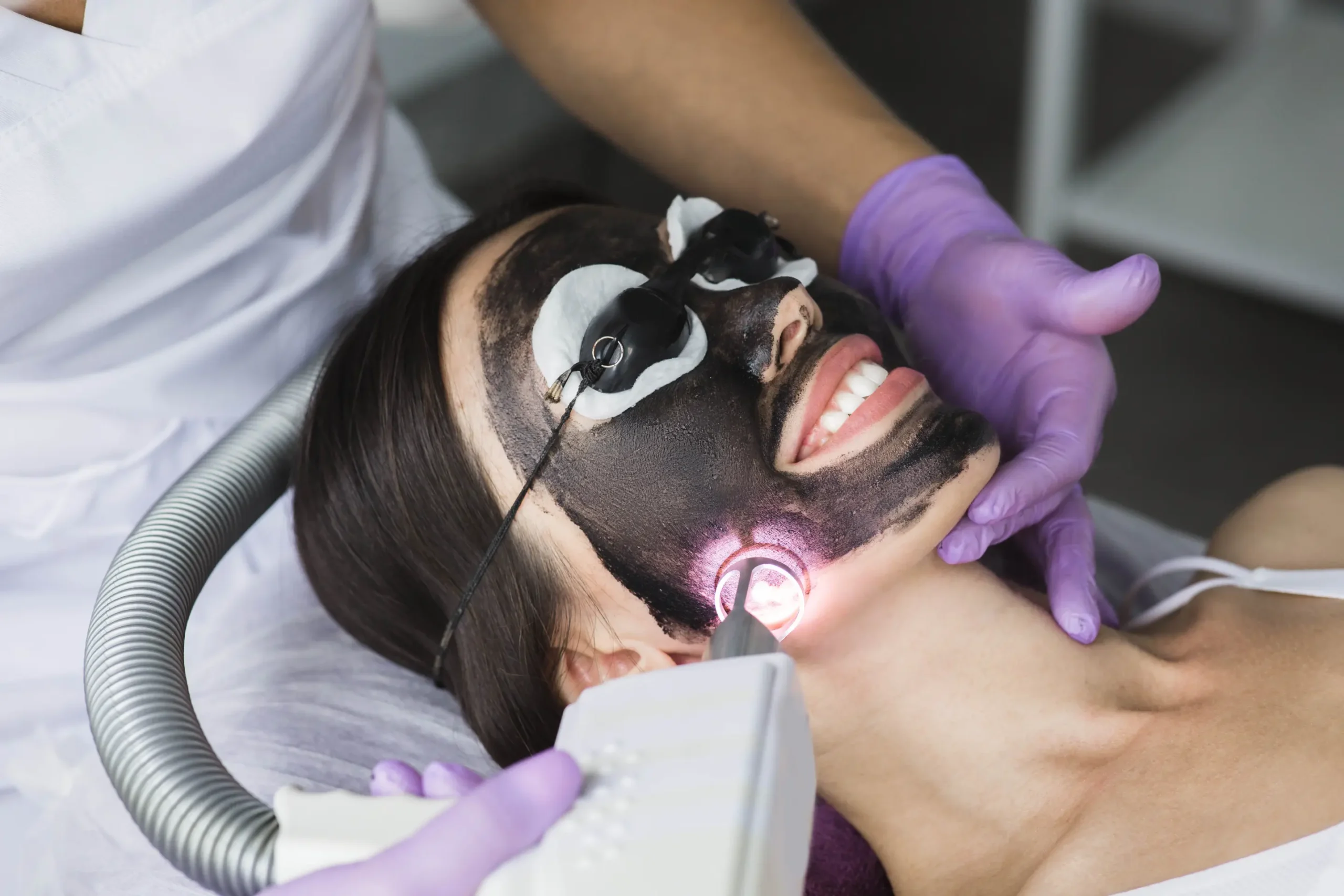 A smiling client with a carbon mask on their face is undergoing a Carbon Laser Peel (also known as the Hollywood Peel).