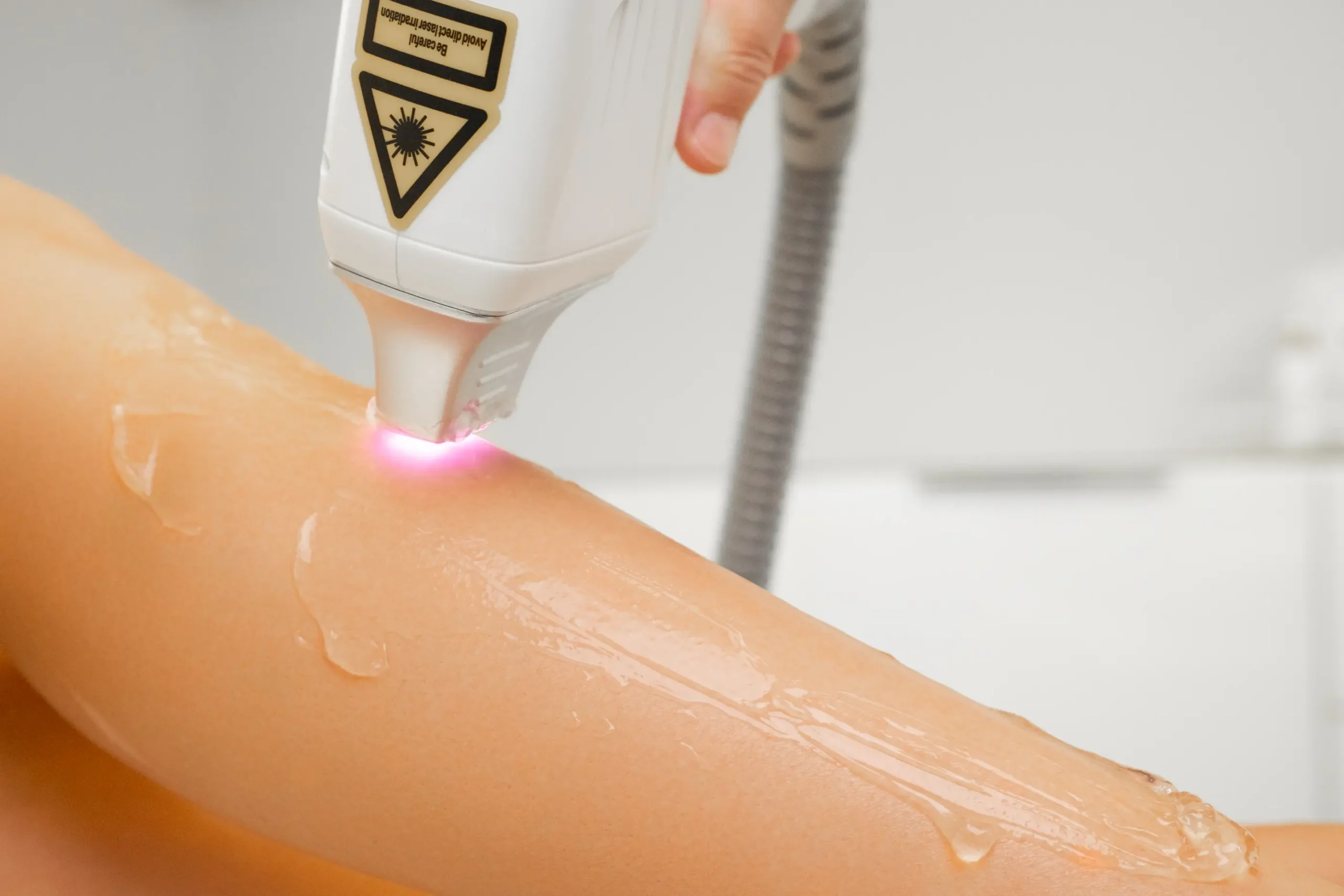 Laser Hair Removal