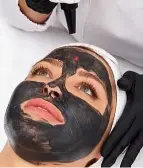 A woman undergoing a Carbon Laser Peel for deep pore cleansing, reduction of blackheads and whiteheads, improved skin texture and tone, and reduction of fine lines and dullness.
