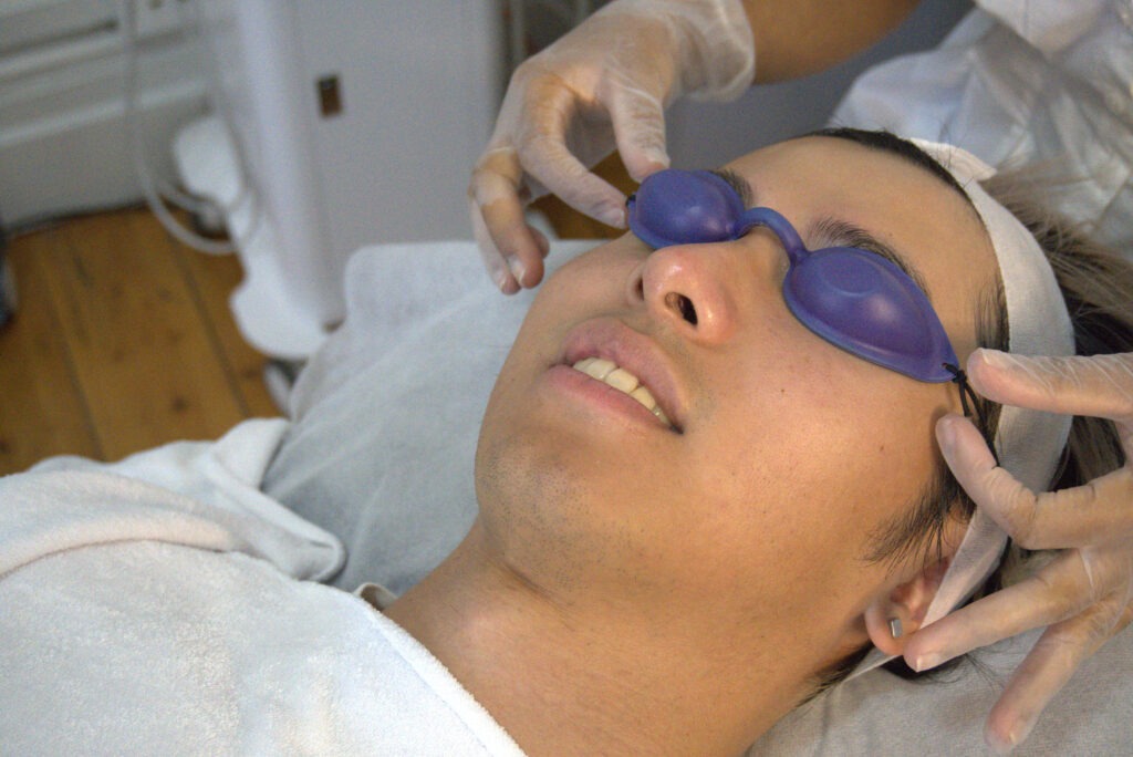 Client with eye protection getting ready for tixel treatment